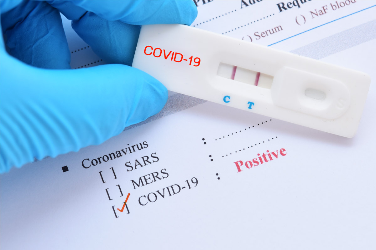 Covid 19 Testing And Positive Test Results